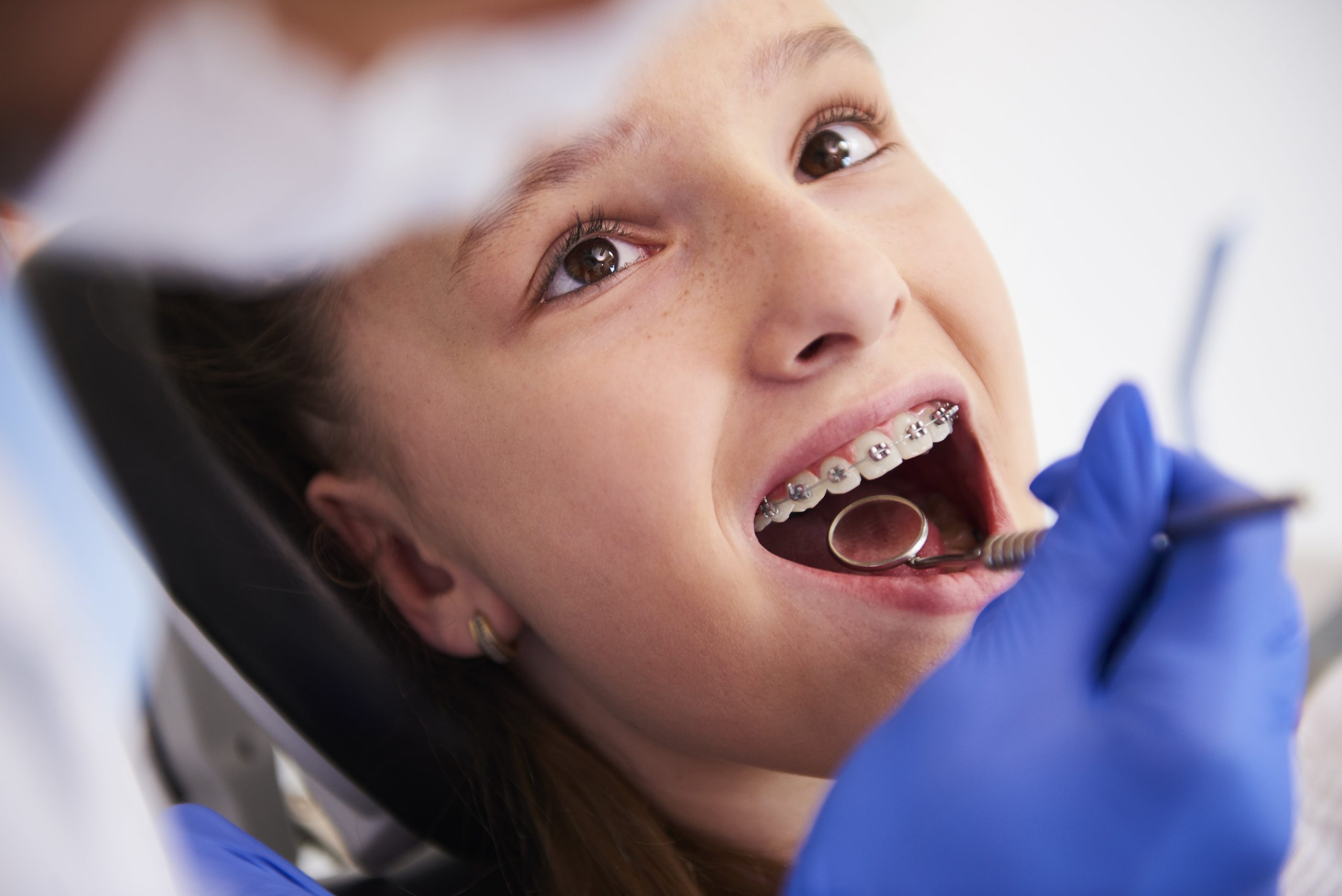Unlock Your Best Smile: PPO Dental Plans Explained