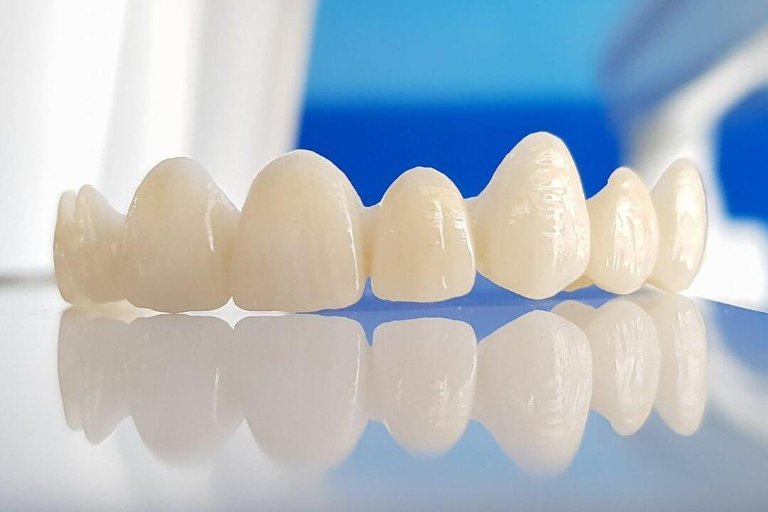 Exploring Zirconia Crowns, Advantages and Their Price