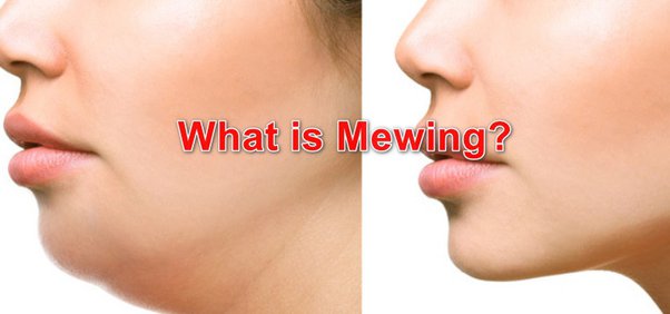 Mewing: The Science and Practice of Facial Transformation